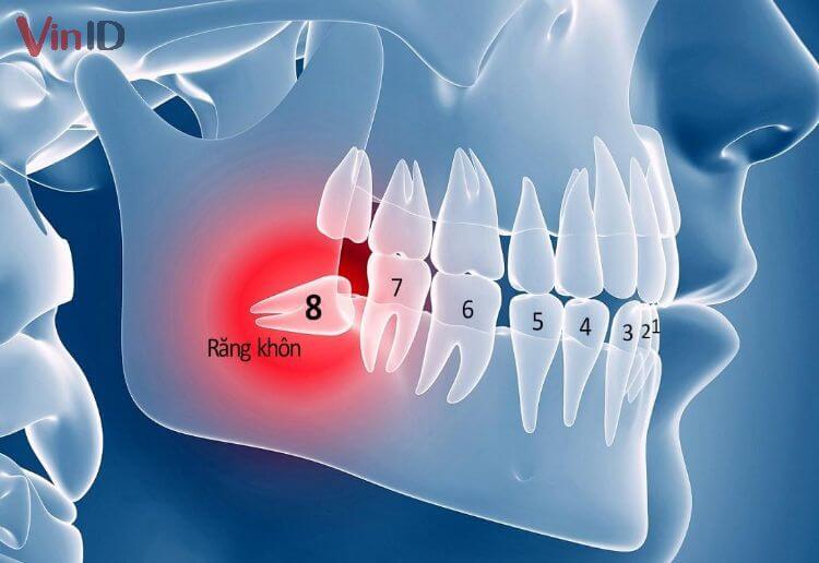  Răng khôn nằm ở vị trí thứ 8 và thường sẽ mọc ở phần cuối cùng