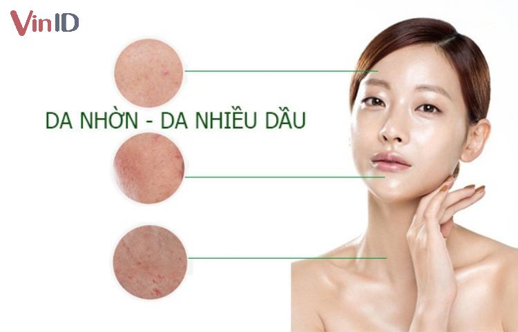 Cách nhận biết da nhờn