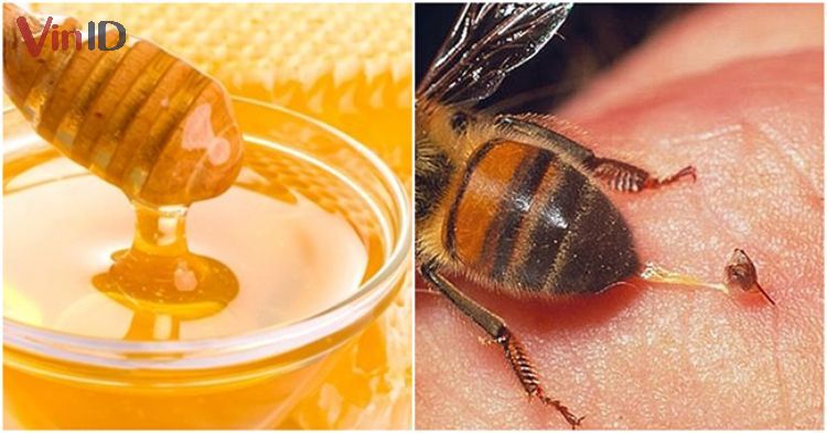Những vết ong đốt không chỉ là nỗi đau khó chịu mà còn khiến cho da bạn trở nên xấu xí. Hãy xem hình ảnh để biết cách xử lý và kiểm soát tình trạng này hiệu quả nhất nhé!