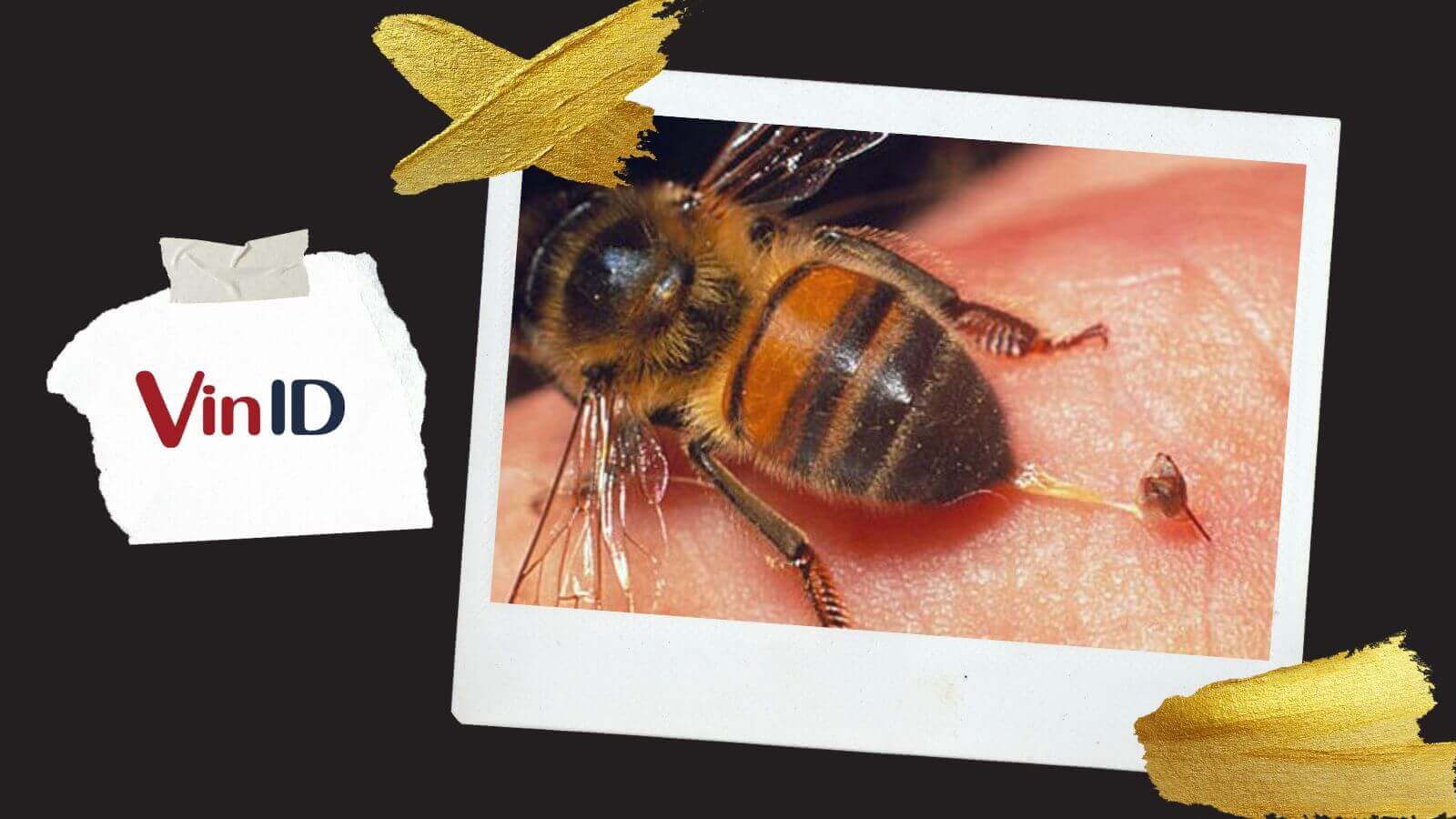 Bị ong đốt bôi gì? Cách xử lý vết ong đốt hết sưng nhức | VinID