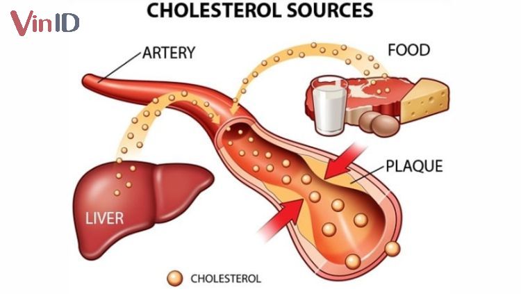 Cholesterol